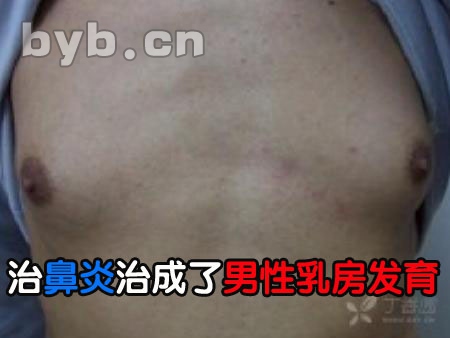 13岁男孩确诊乳腺炎非女性专属 男性亦需警惕